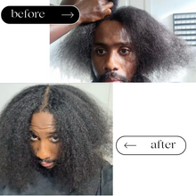Load image into Gallery viewer, Hair Growth Serum