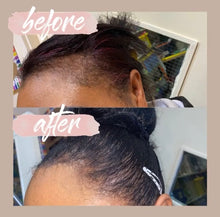 Load image into Gallery viewer, Edges Growth Serum