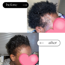 Load image into Gallery viewer, Edges Growth Serum
